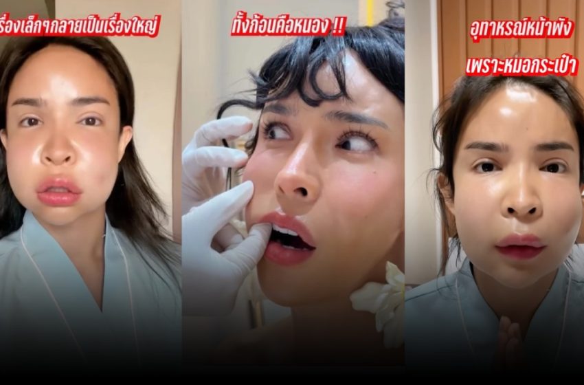  อึ้งเลย!  “นัท นิสามณี” เผยโฉมหน้าพัง! เพราะหมอกระเป๋า 